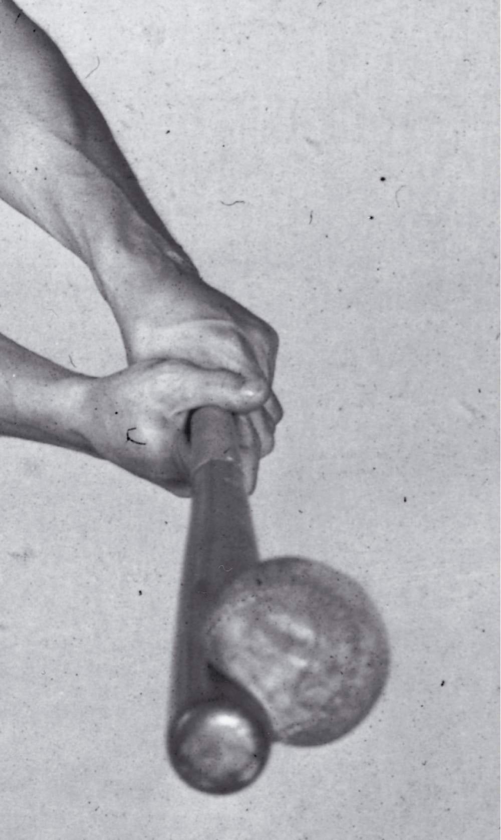 Pesapalli deformatsioon