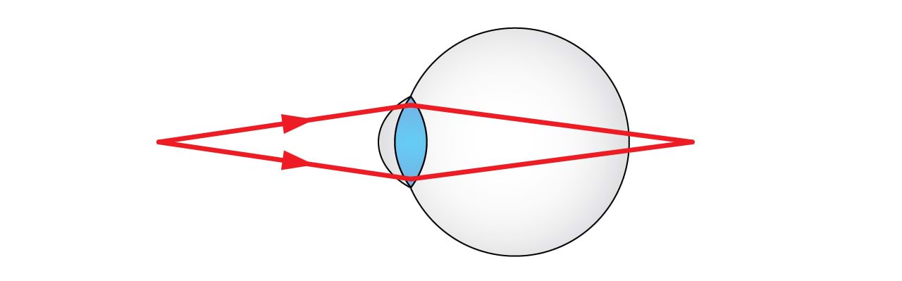 Kaugnägija vaatab lähedale