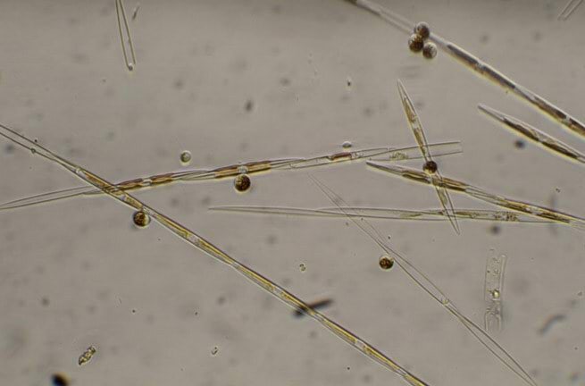 Pseudo-nitzschia <br>