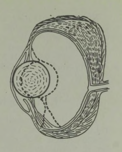 Kala silma läbilõige<br>
