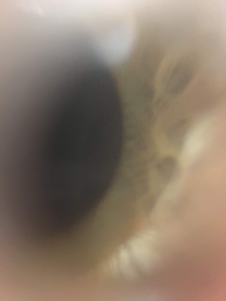 Silm mobiilimikroskoobis