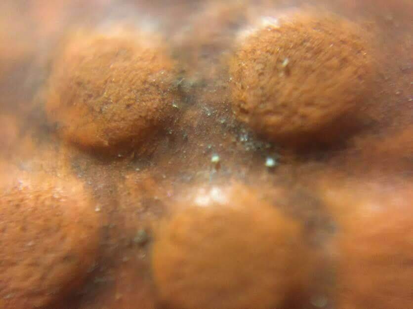 Korvpall mobiilimikroskoobis