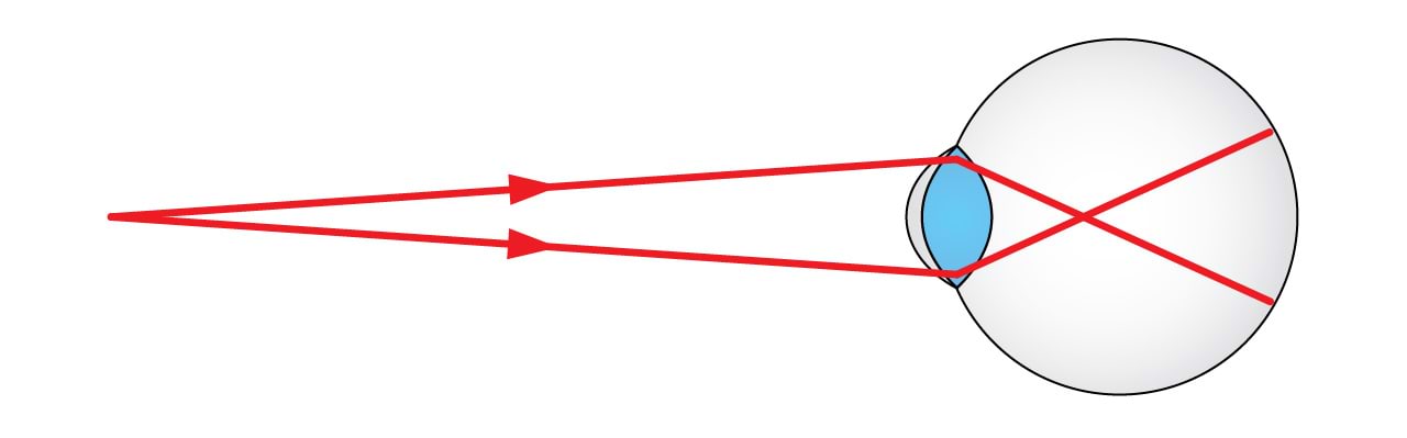 Lühinägija vaatab kaugele